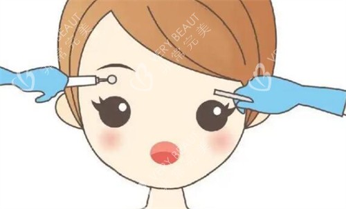 纹眉前后对比