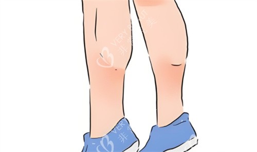 肌肉型小腿