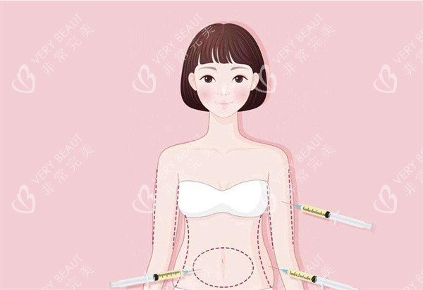 自体脂肪填充