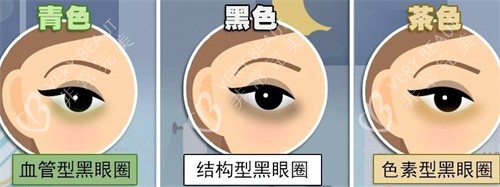 不同的黑眼圈类型
