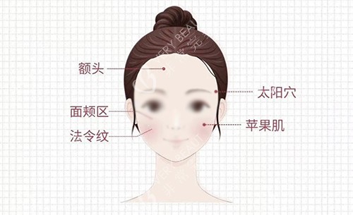 皮贴骨面部注射区