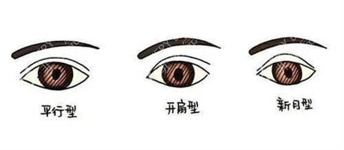 双眼皮