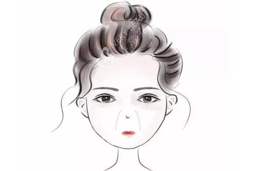 鼻唇沟图片展示
