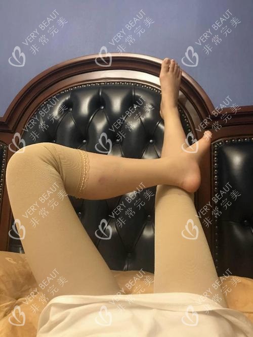 塑身衣术后<span style=