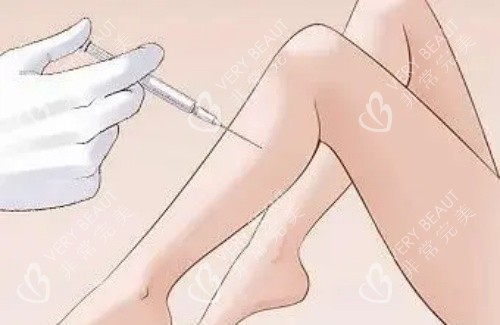 注射瘦腿示意图