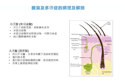 腋臭怎么办