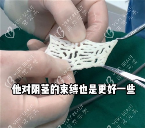 阴茎生物补片材料样子