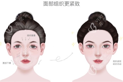 耳基底填充前后对比