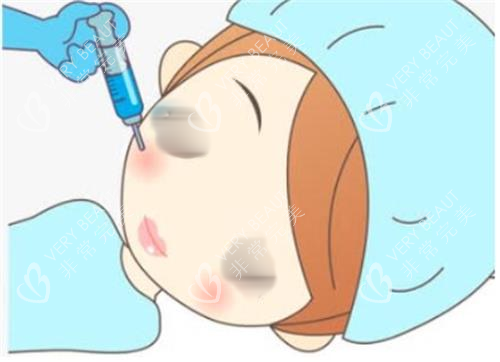 打针瘦脸手术过程图