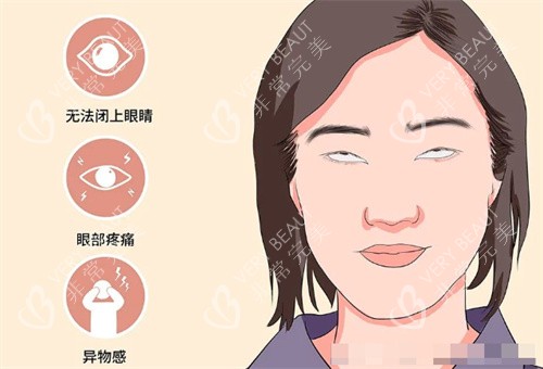 需要做眼修复的情况