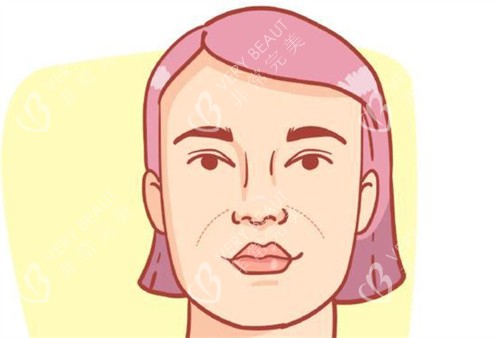 法令纹图片