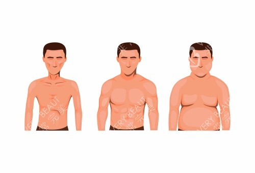 男性乳房发育吸脂后图片示意图