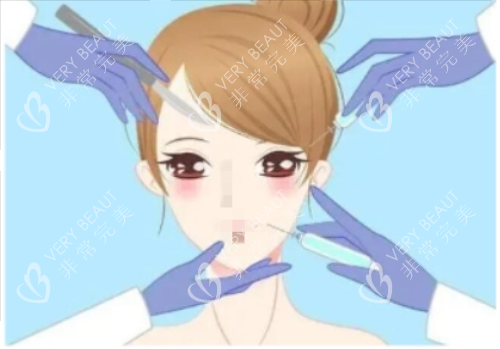 打针除皱示意图