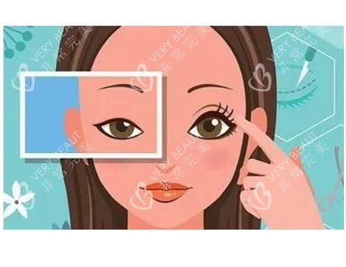 开眼角明显对比<span style=