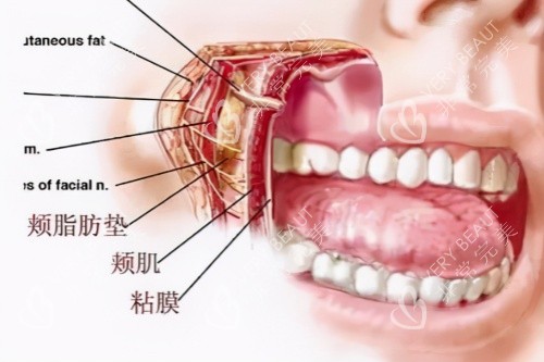 颊脂垫图片一览