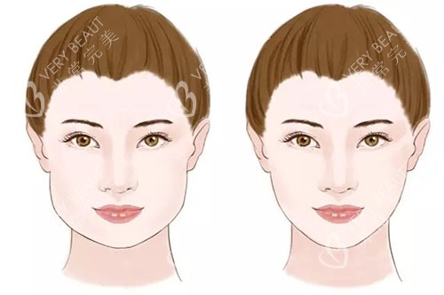 瘦脸卡通对比图