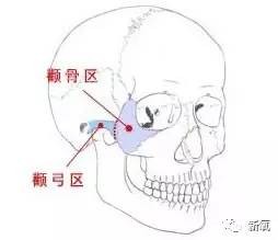 颧骨骨骼图