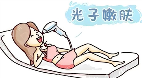 光子嫩肤图