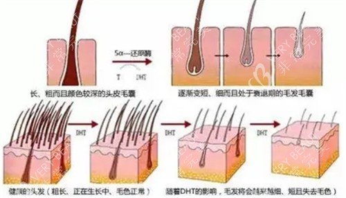 毛囊的不同健康情况