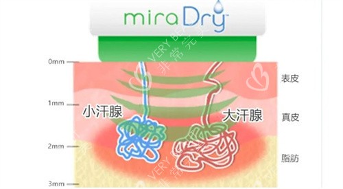 清新微波治療原理