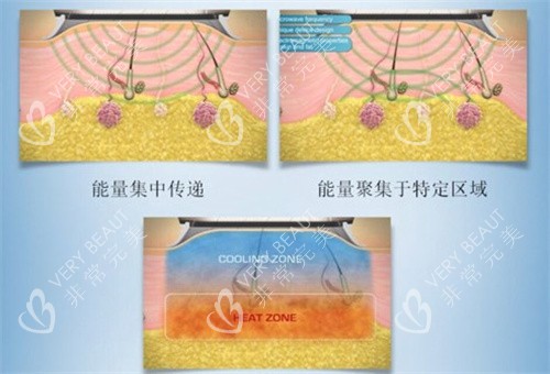 清新微波工作原理