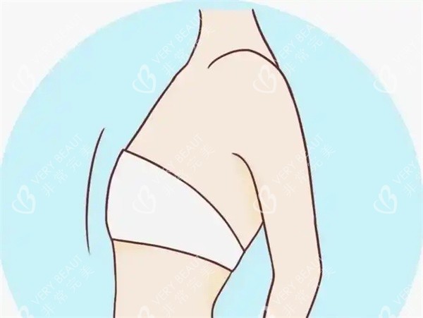 胸部缩小术