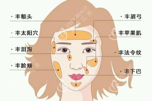 自體脂肪面部填充卡通圖