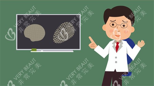 颅骨修复材料的对比动画图