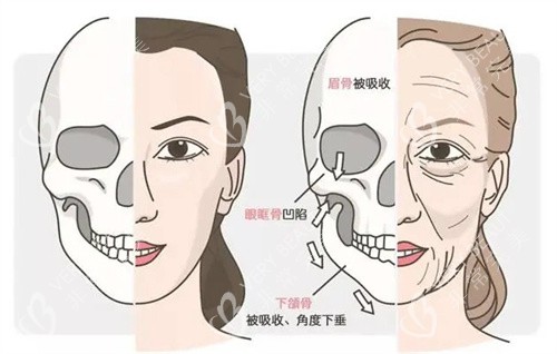 年轻和老化的面部骨骼