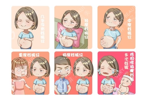 各類妊娠紋圖片展示