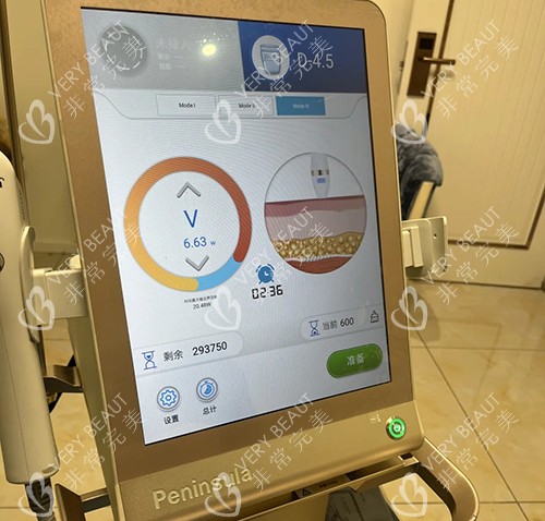 黄金超声炮