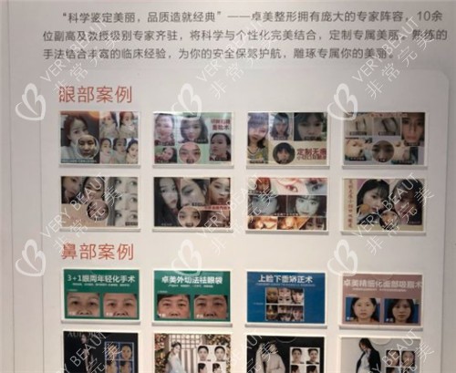 武汉硚口卓美整形展示墙