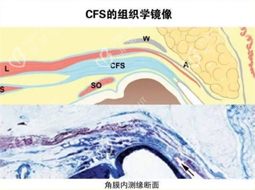 cfs原理图