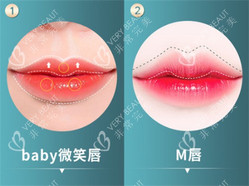不同唇形對比圖