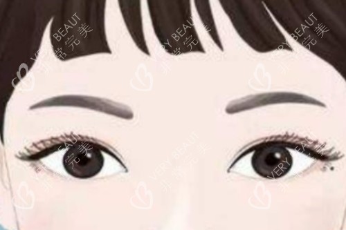 全切雙眼皮卡通圖一覽
