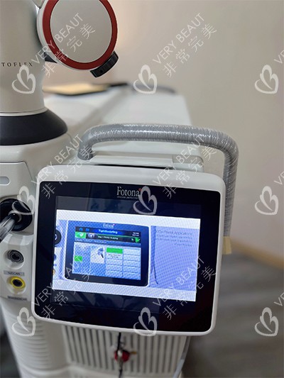 欧洲之星fotona4d仪器图