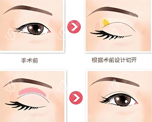 全切設(shè)計(jì)圖