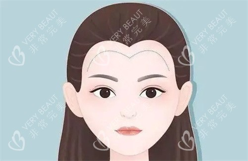植發(fā)際線卡通