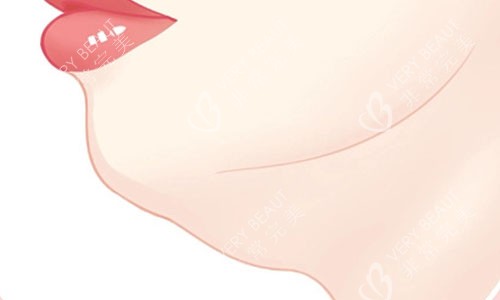 雙下巴的動(dòng)畫(huà)圖
