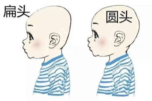 圆头、扁头对比图