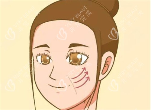 拉皮手术图片