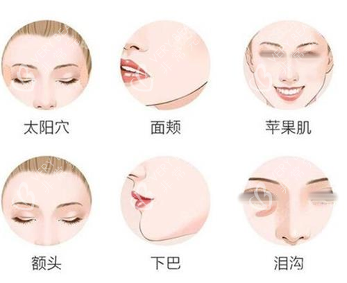 面部填充部位一覽圖