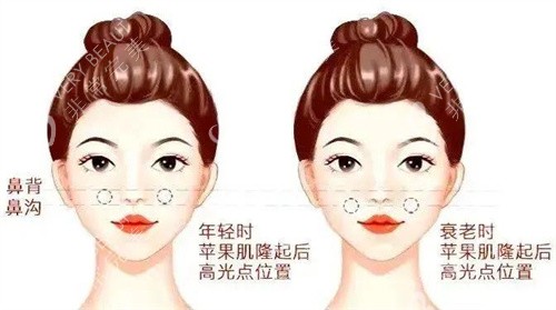 幼態(tài)臉面部平整度高