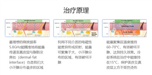 清新微波去腋臭技术原理图解