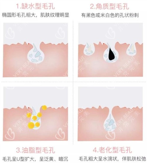 不同問題的毛孔