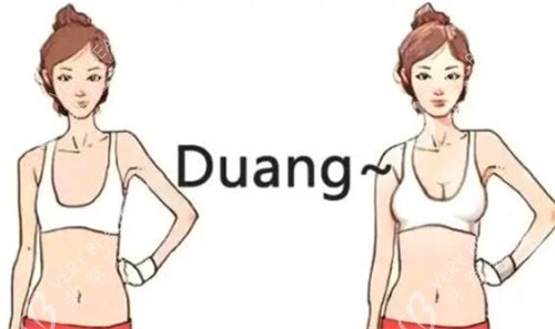 隆胸對(duì)比