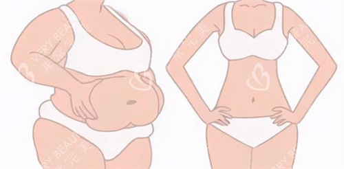 激光溶脂瘦腰腹对比图