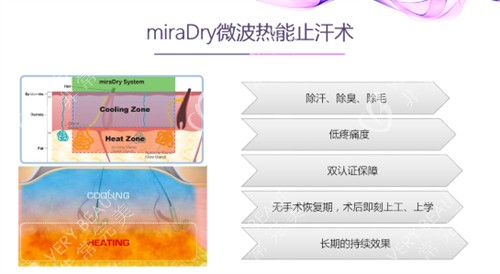 miraDry清新微波功效