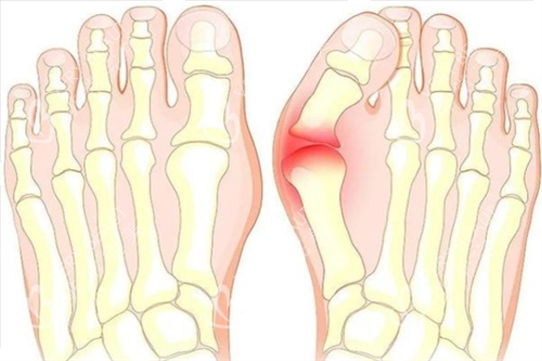 大腳骨腳步骨頭透視圖