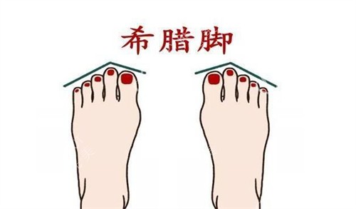 希腊脚照片图卡通